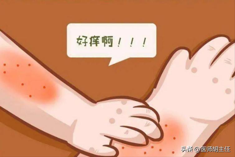 湿疹和荨麻疹汗疱疹同时出现吗,汗疱疹后期干裂瘙痒用什么药