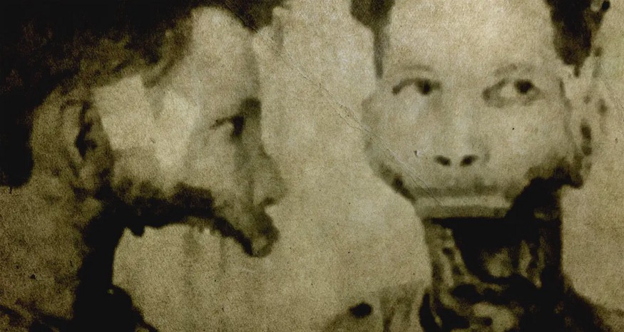 男子喝下核辐射水下巴融化,男子喝下千瓶辐射水