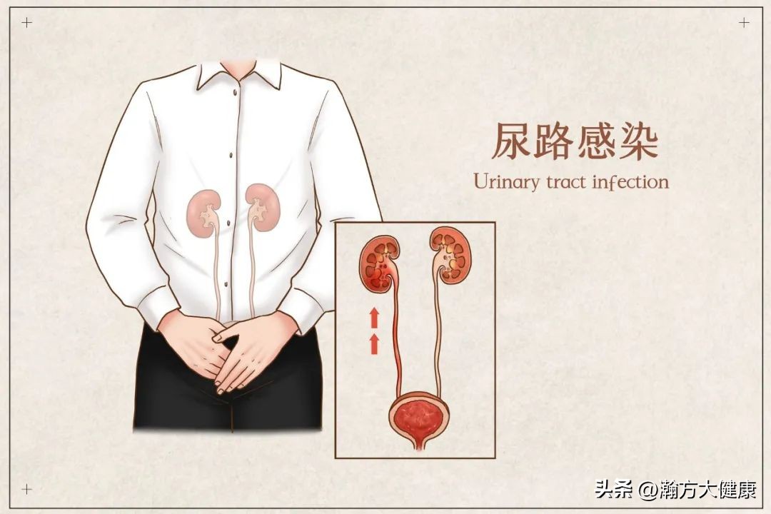 尿路感染容易引起感冒吗,患上了尿路感染怎么办