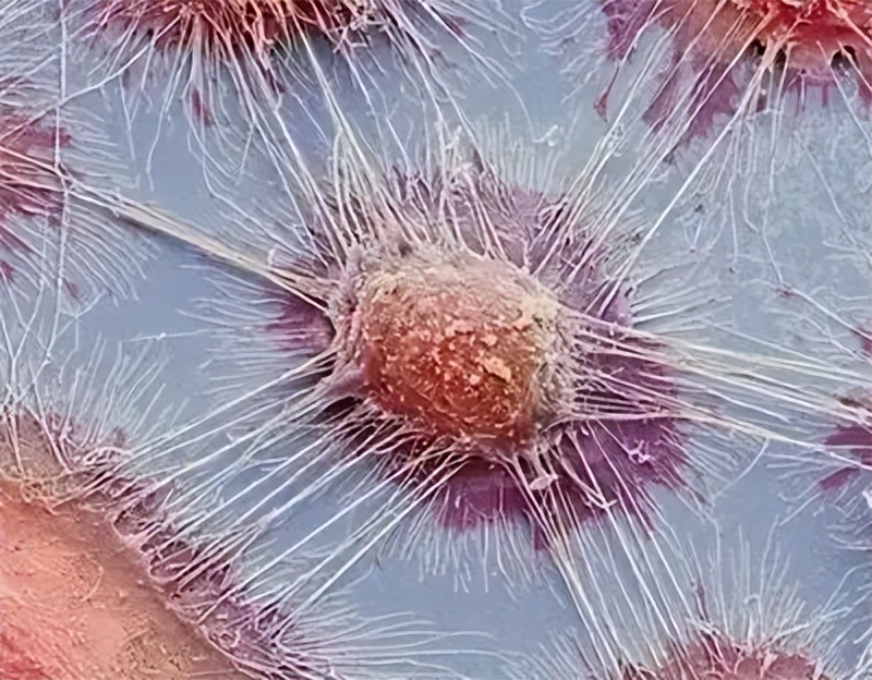 能不能用发烧来抑制癌症,一年适当的发烧可以防止癌症吗