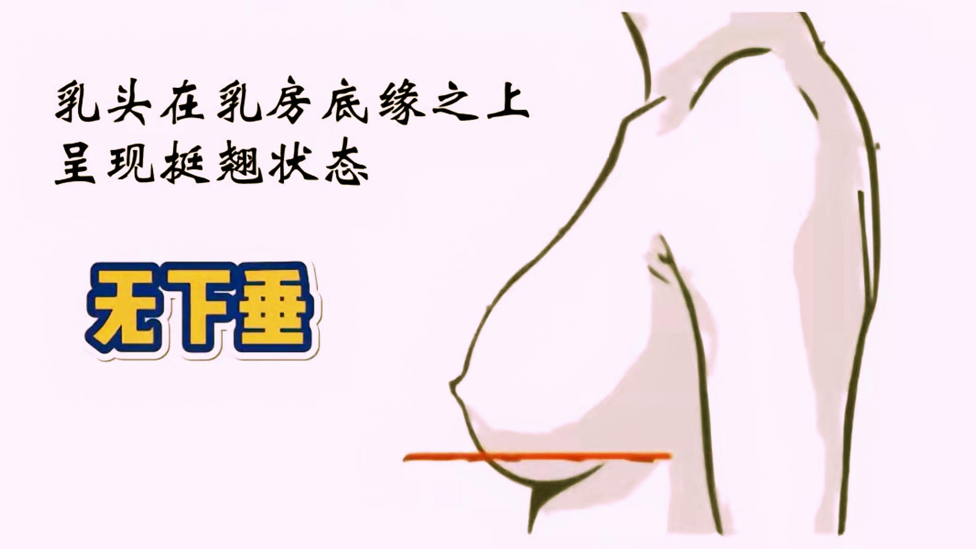 女人胸部下垂大小不一是什么问题,23岁胸部有一点下垂应该怎么办