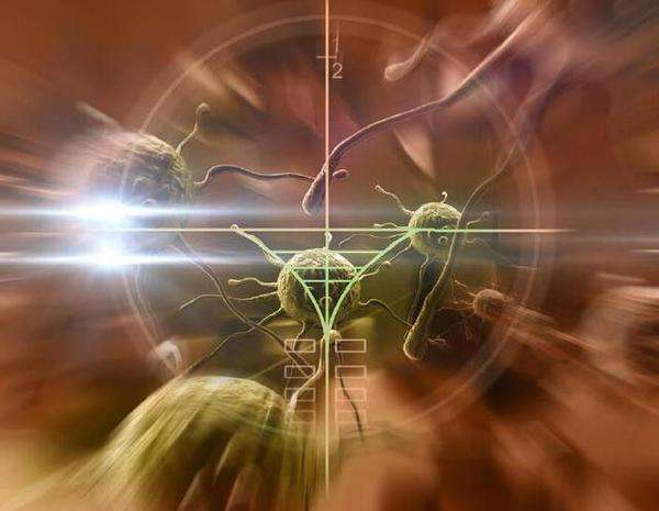 最适合放疗的癌症,哪种肿瘤需要放疗