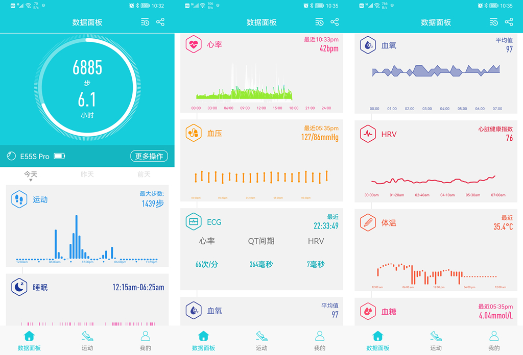 didoe55高精准多功能测血糖手表,didoe55智能手表测血糖靠谱吗