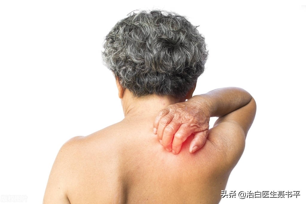 不痛不痒的白斑突然痒了，是我们做错了什么吗？