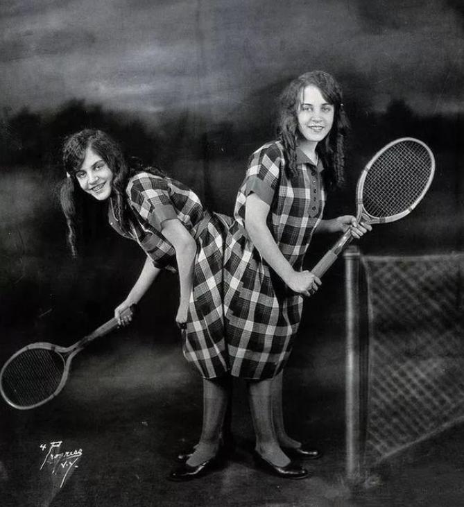 英国连体双胞胎姐妹,英国连体姐妹