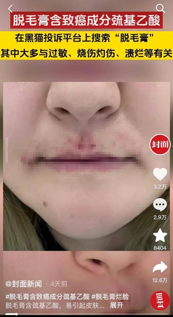 网上买的脱毛膏致癌怎么举报,脱毛膏真的致癌吗