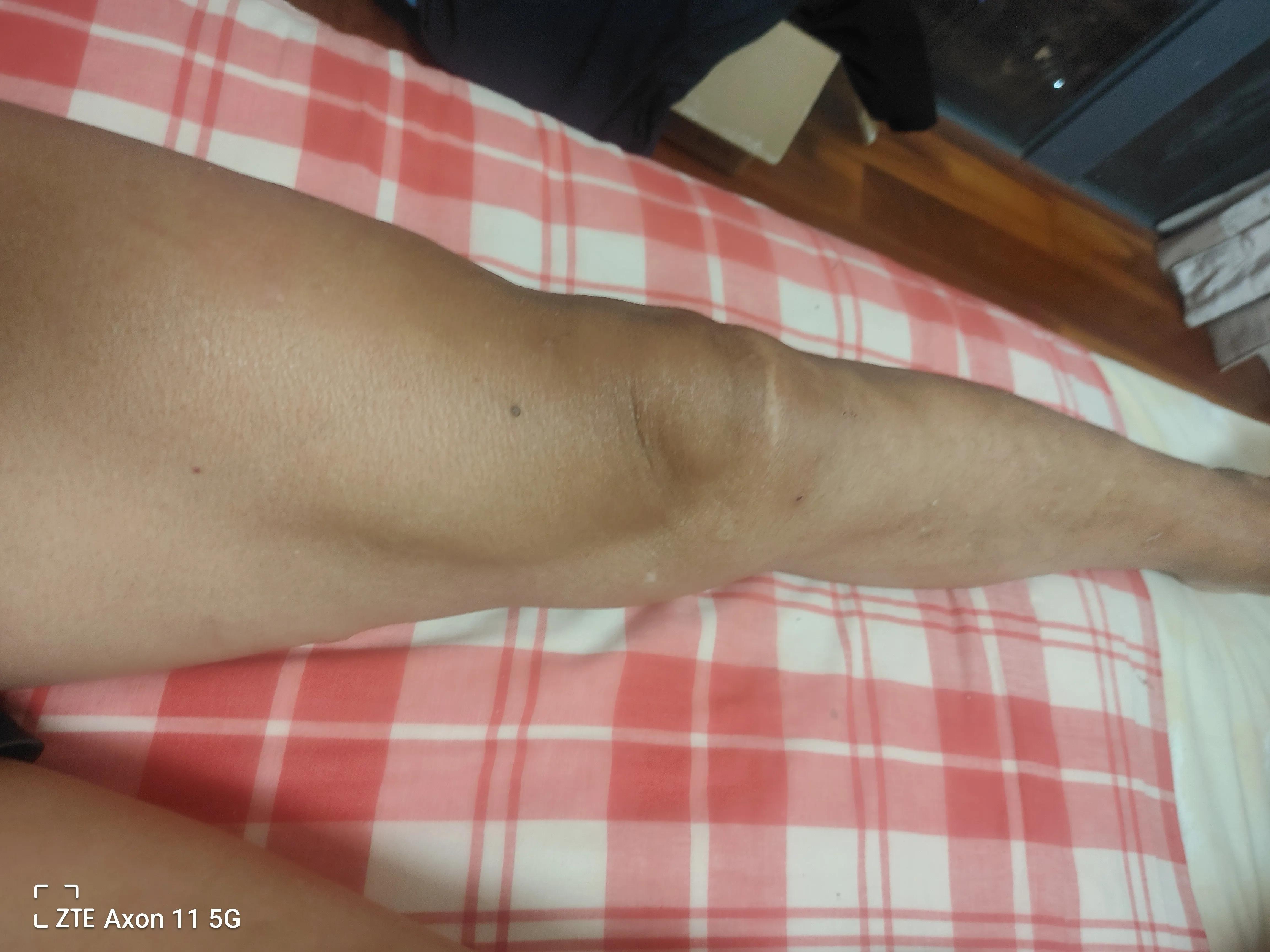 在一家医院做手术需要多少钱,去医院问做手术多少钱该去哪里问