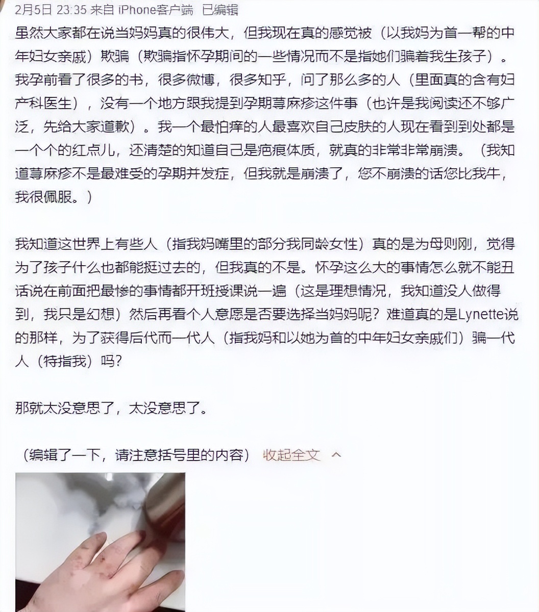 赵小侨为什么胎停,赵小侨早产