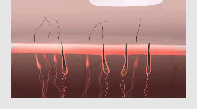 夏天脱毛的最佳时间,夏天脱毛的真实感受