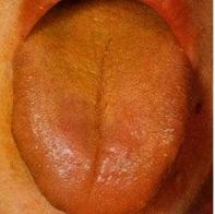 手脚心热吃六味地黄丸咋不见效呢,手脚心发热口干吃知柏地黄丸好吗