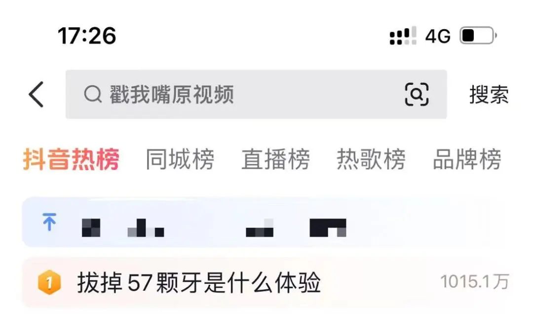 成年人患上牙瘤从牙里拔出57颗牙,一女生患牙瘤拔掉57颗牙