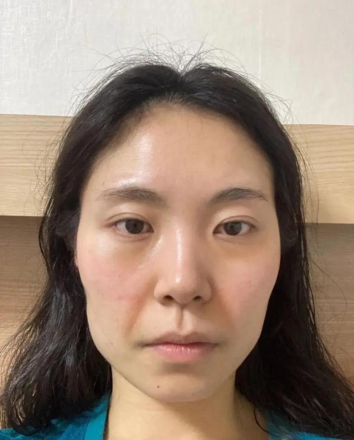 八大处医院杨喆抖音,八大处整形医院杨喆