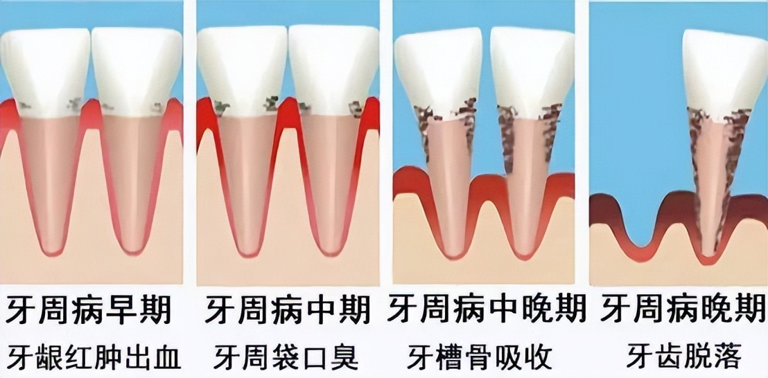 飞利浦电动牙刷9系和欧乐b9系,欧乐b和飞利浦电动牙刷怎么选