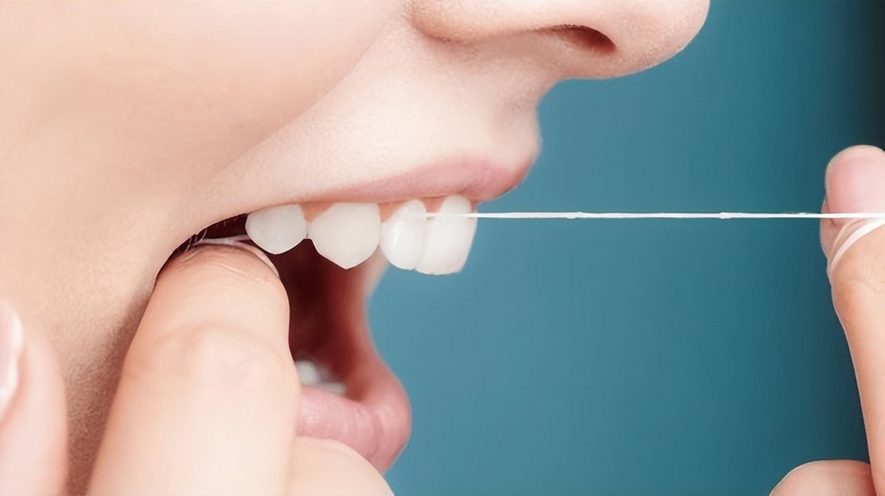 牙齿上抠下来的白色的东西臭臭的,从牙齿里抠出的臭臭的东西是什么