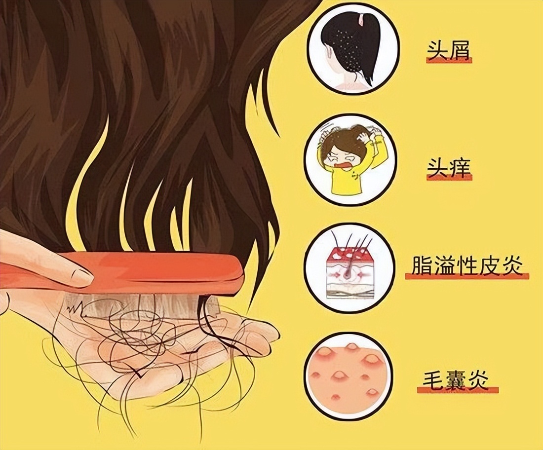 头皮上总出油长有疙瘩或脓包,头皮有疙瘩脓包痒痒用什么药