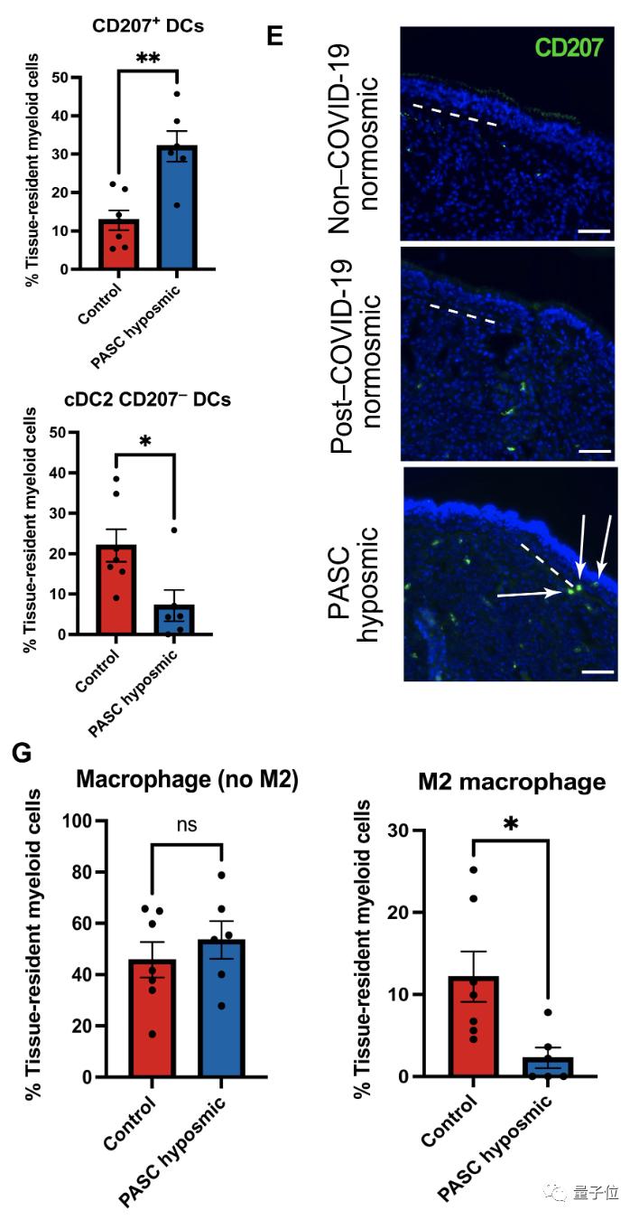 新冠后丧失嗅觉的关键原因找到了,新冠丧失嗅觉是怎么回事