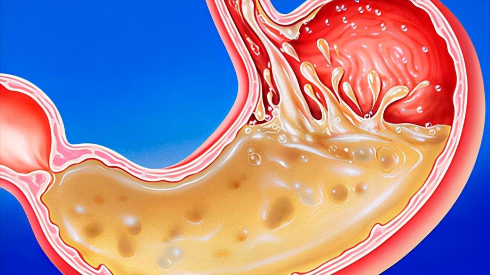 大蒜洋葱降血压还需吃降血压药吗,黄瓜降血压好还是洋葱降血压好