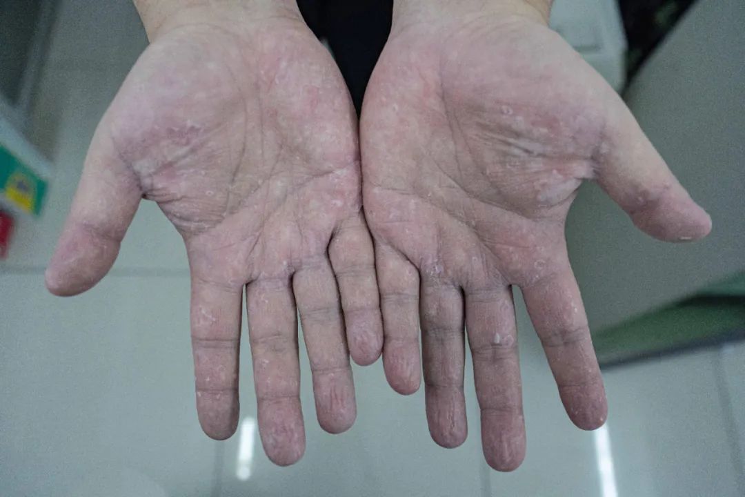 移民管理警察值守边境一线,移民管理警察雨中为群众撑伞