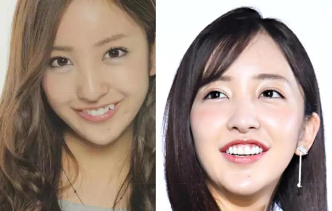 日本整牙的明星,日本整牙明星