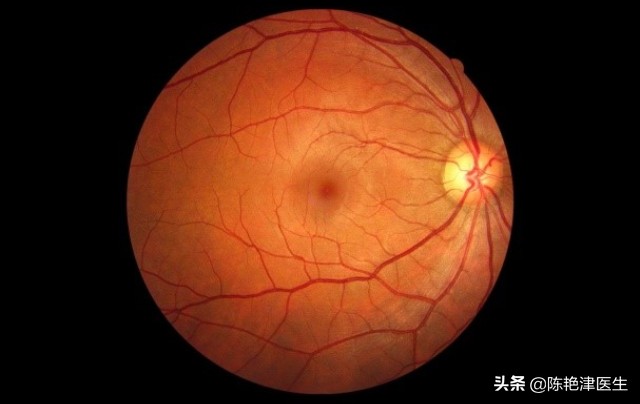 坐骨神经受损吃甲钴胺有用吗,甲钴胺能治疗神经损害吗