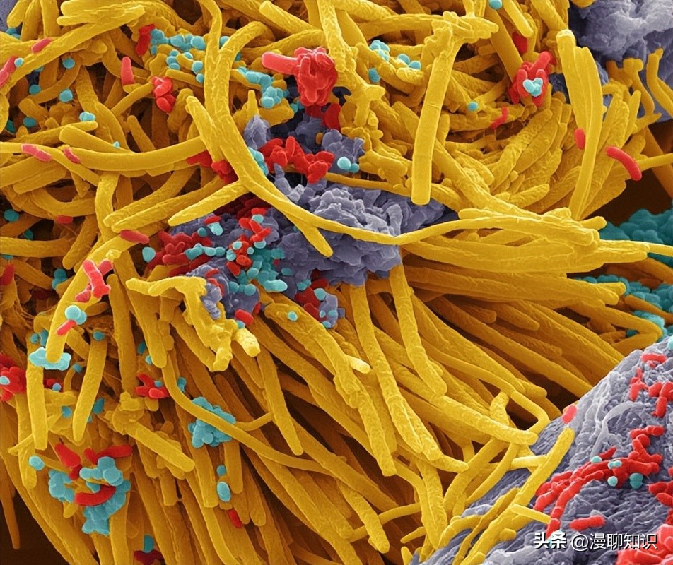 慢性复发性骨髓炎儿童案例,青少年得慢性骨髓炎能治好吗