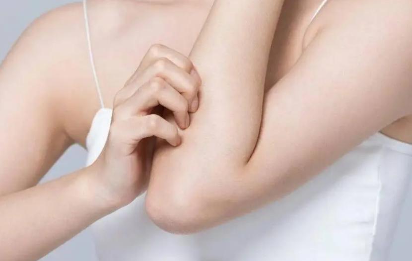 中医治湿疹止痒10大软膏,祖传秘方药膏治湿疹