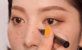 夏天怎样去除晒斑,如何防止夏季雀斑加深