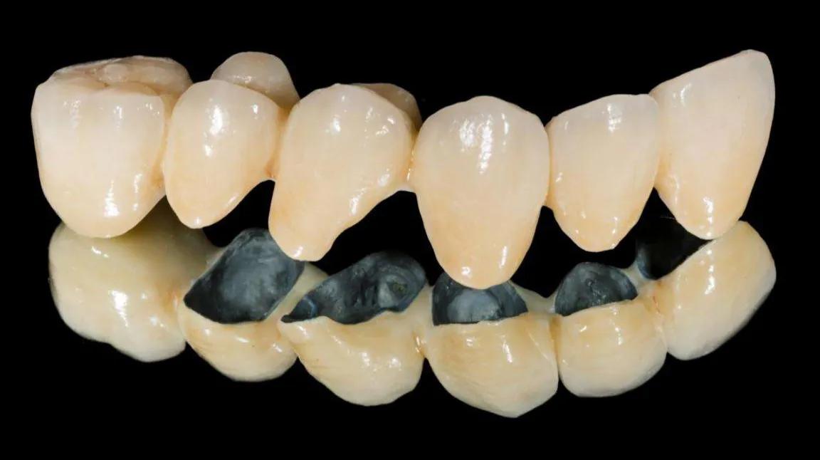 违反国家规定生产销售假牙，构成非法经营罪被判了