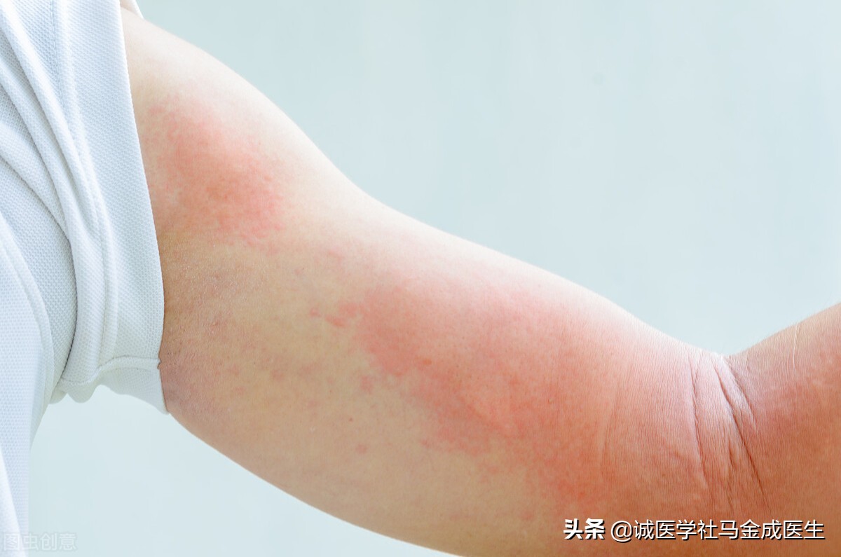 经常皮肤瘙，讲两味血肉有情的中药，止痒，祛风，解毒，杀虫