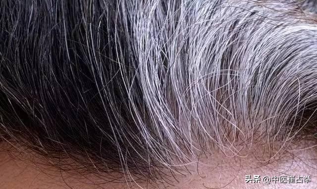 倪海厦中医养发生发的有效方法,倪海厦讲治脱发生发处方