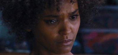 故事:非洲17岁女孩长满络腮胡,毛发从鼻孔长到脖子,身体有何异常