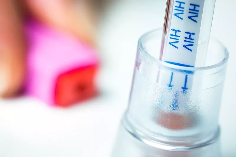 警惕艾滋病皮肤病,艾滋病会出现的初期皮肤病