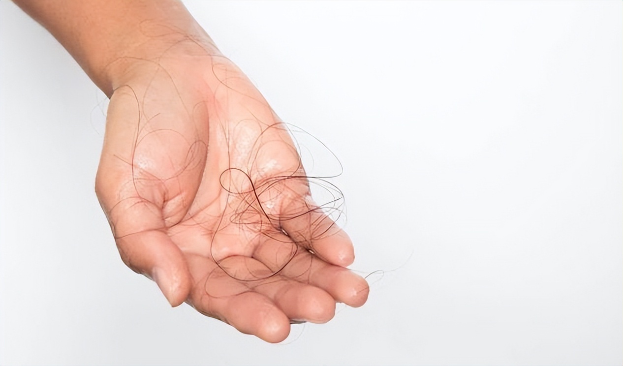 女性脱发的原因及解决方法,女性脱发比较严重防治方法