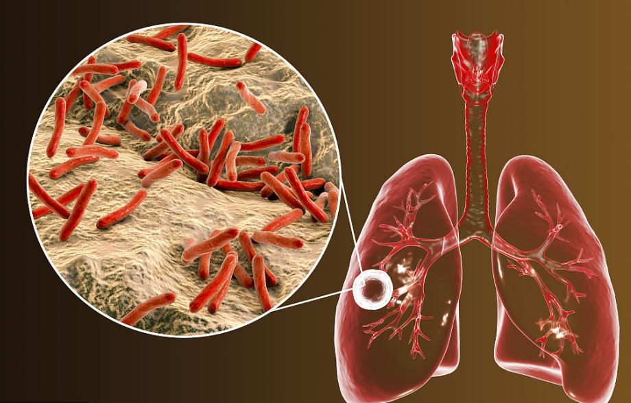 医院专家证实这17种病纯属忽悠,这6种病无法治愈别再被骗