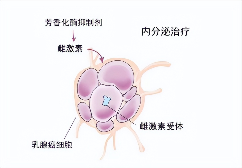 内分泌治疗多久会出现耐药,怎么知道内分泌药耐药了