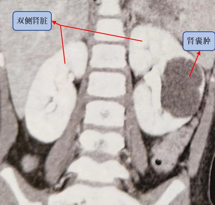 6岁儿童突然肚子疼怎么回事,6岁小孩肚子突然痛怎么回事