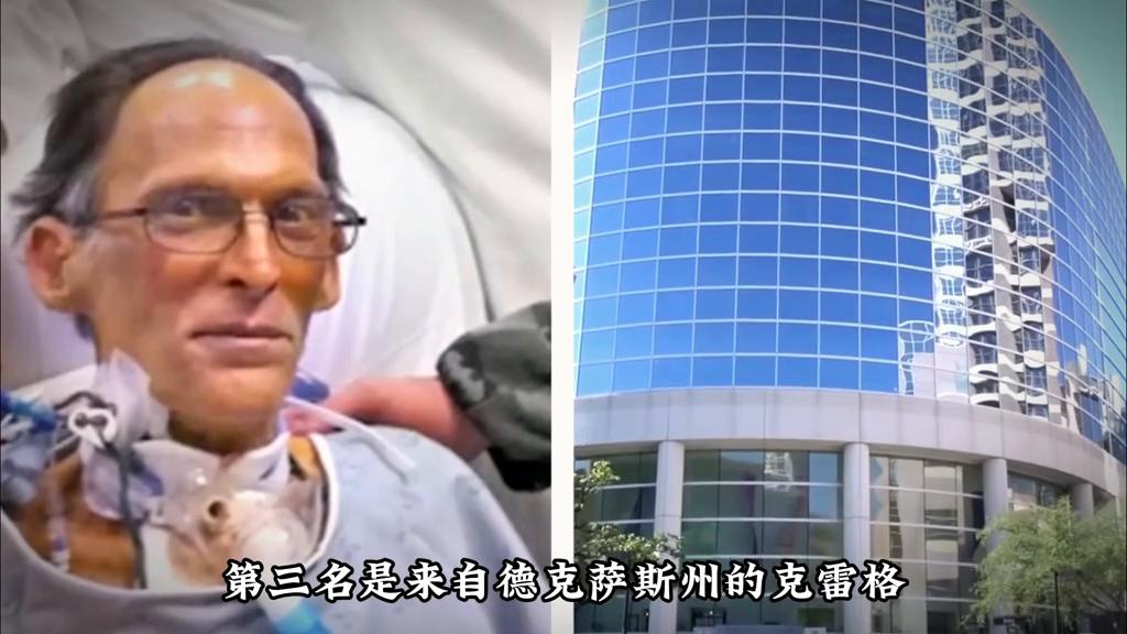 没有鼻孔的人长什么样,没有鼻孔的人视频