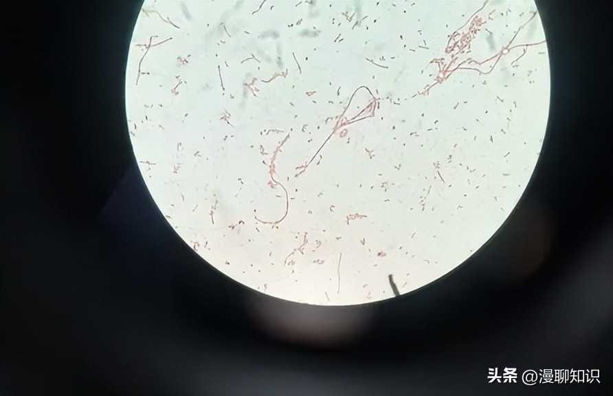 大肠杆菌的结构名称,大肠杆菌菌株基因型