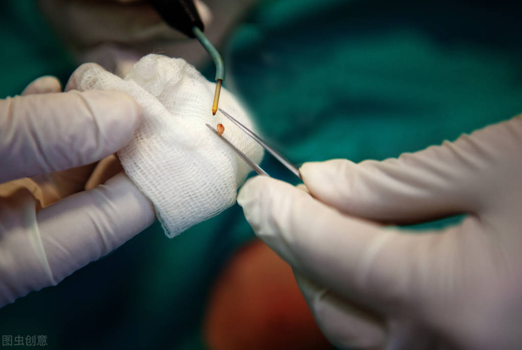 皮肤长小疙瘩小肉球怎么弄,皮肤上长了小肉球要怎么才能治好