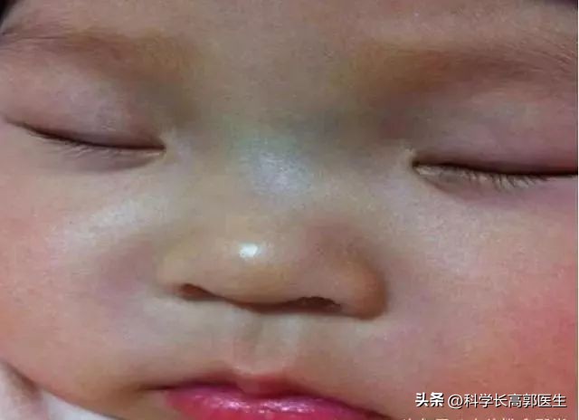 孩子咳嗽发烧反反复复是怎么回事,孩子咳嗽发烧的最佳治疗方法