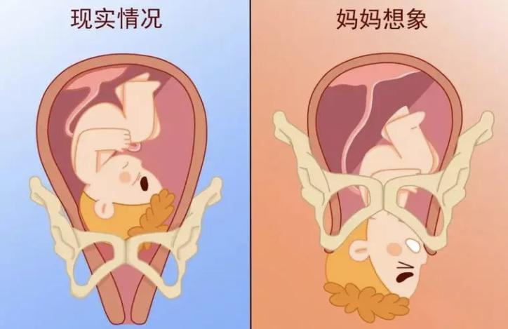 6个动作教你缓解分娩阵痛,分娩疼痛怎么缓解