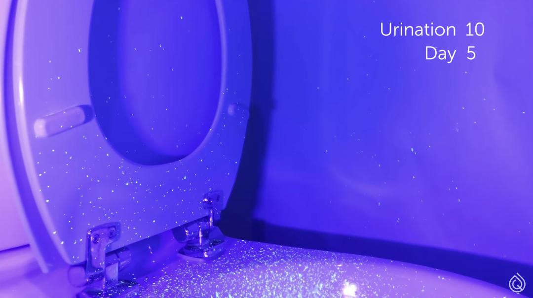 被公厕便池的水溅到,会得性病吗?|8个如厕烦恼全解