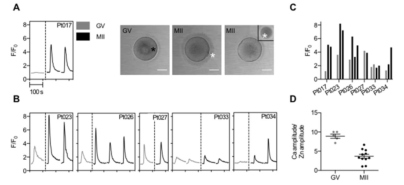 科学家发现人类精子和卵子,科学家捕捉精子和卵子作用