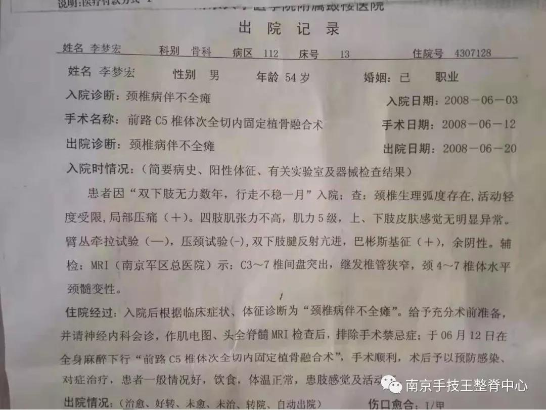 脊髓型颈椎病自愈的最快方法,脊髓型颈椎病的克星