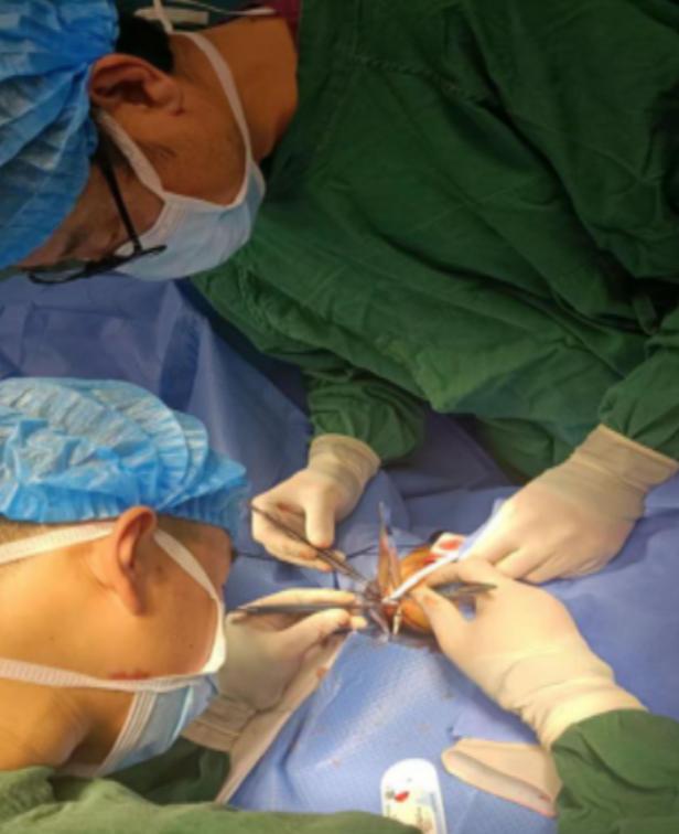 人工血管透析的效果,人工血管血液透析