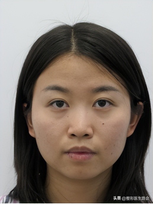 什么样的人做了鼻子变化大,做的鼻子和真鼻子区别大吗