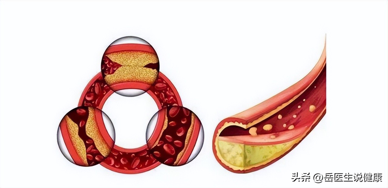谷维素治疗失眠怎么服用最安全,谷维素是治疗失眠高血脂的良药