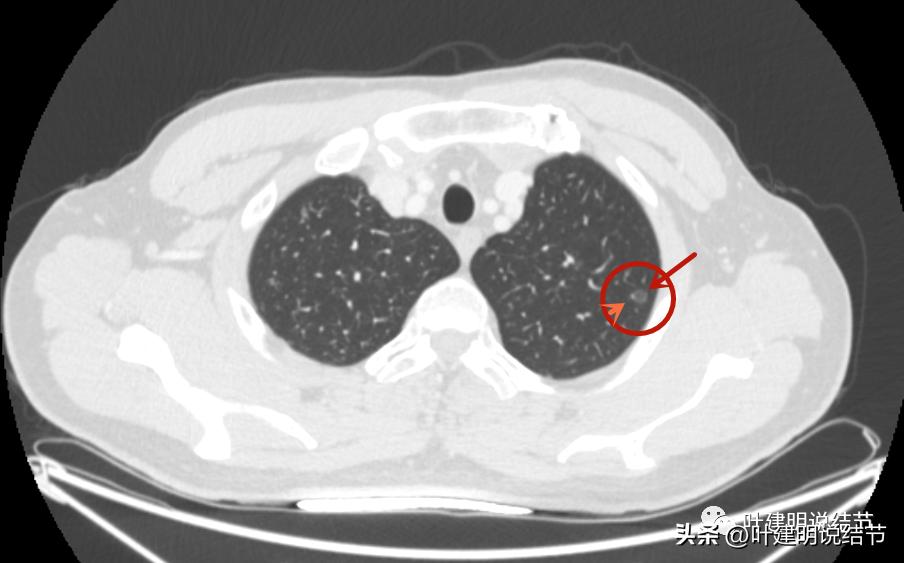 医生为了预防医患矛盾过度诊疗,医院过度医疗手术