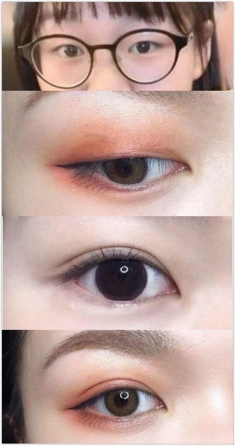 上海做双眼皮哪个医院好,上海哪个医院做双眼皮最好