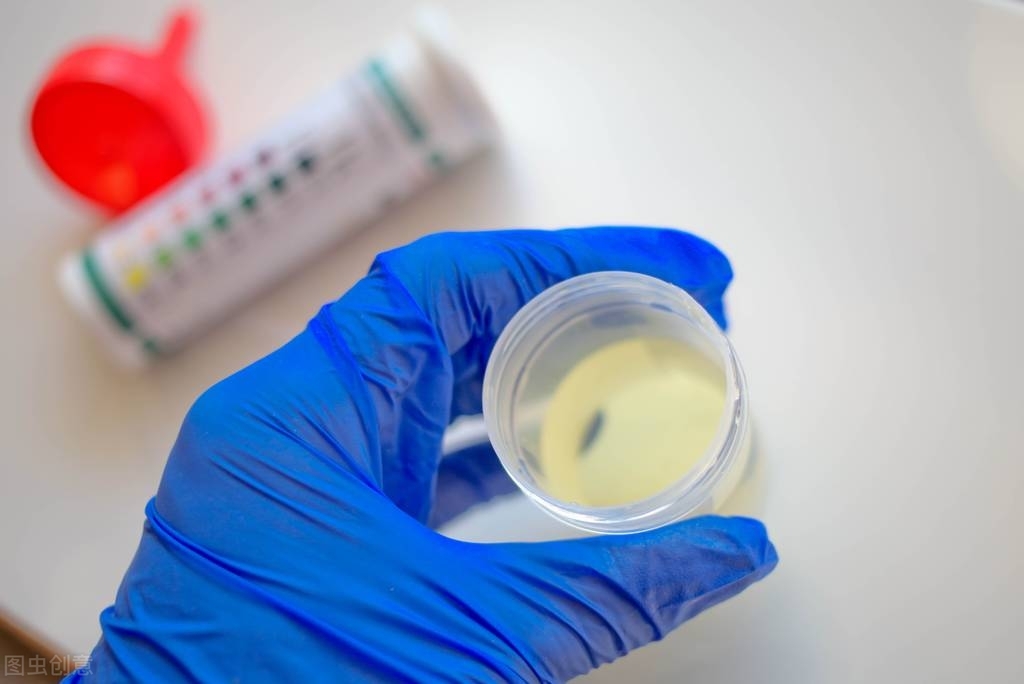 尿毒症怎么快速补充蛋白,蛋白肌酐过高怎么办